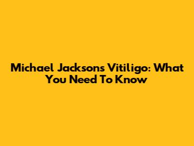 Michael Jackson's Vitiligo: What You Need To Know