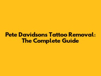 Pete Davidson's Tattoo Removal: The Complete Guide